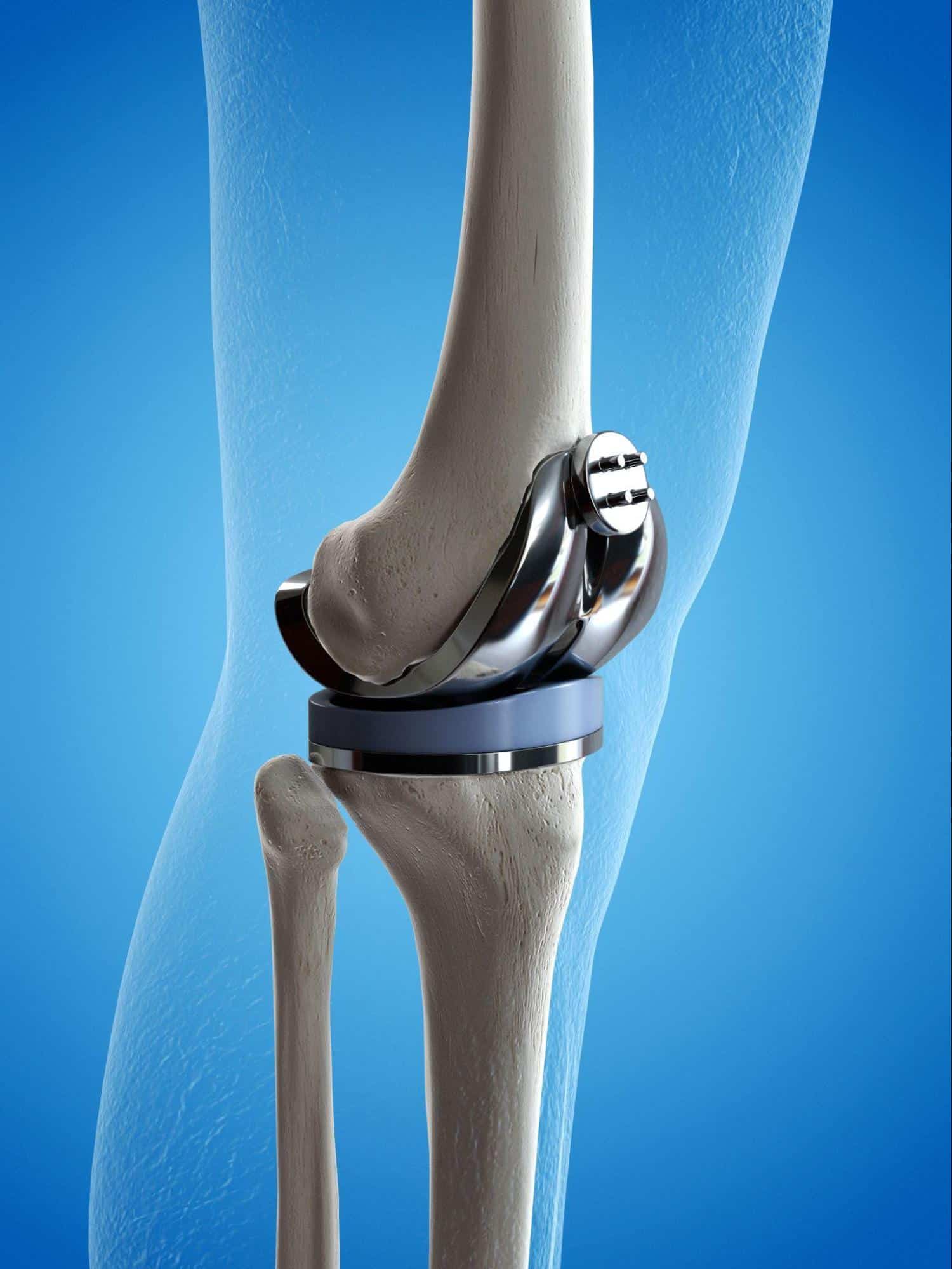 Knee pain